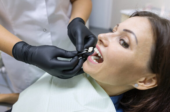 types-of-cosmetic-dentistry-north-york