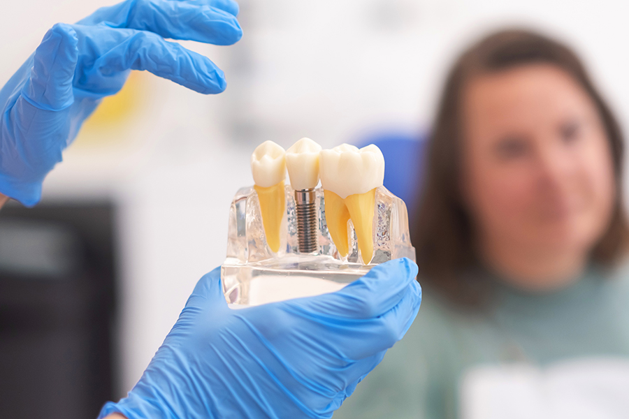 dental-implant-benefits-north-york-dentist